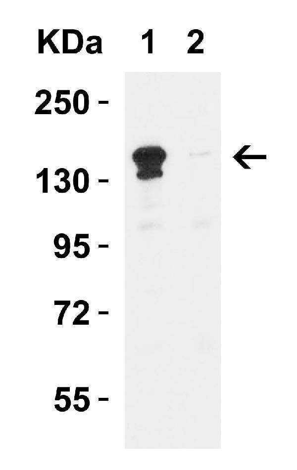 a01309 kdm6b primary antibodies wb testing 5