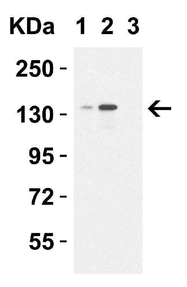 a01309 kdm6b primary antibodies wb testing 6