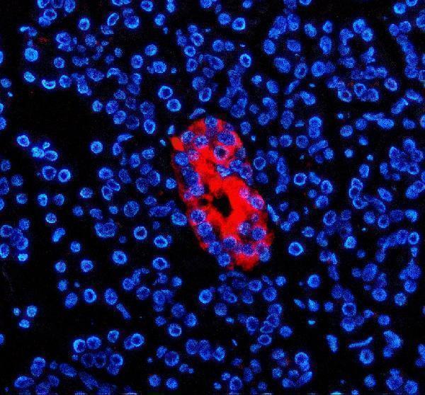 IF analysis of ZNT8/SLC30A using anti-ZNT8/SLC30A antibody (A01310-1)