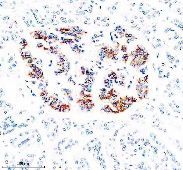 IHC analysis of ZNT8/SLC30A using anti-ZNT8/SLC30A antibody (A01310-1)