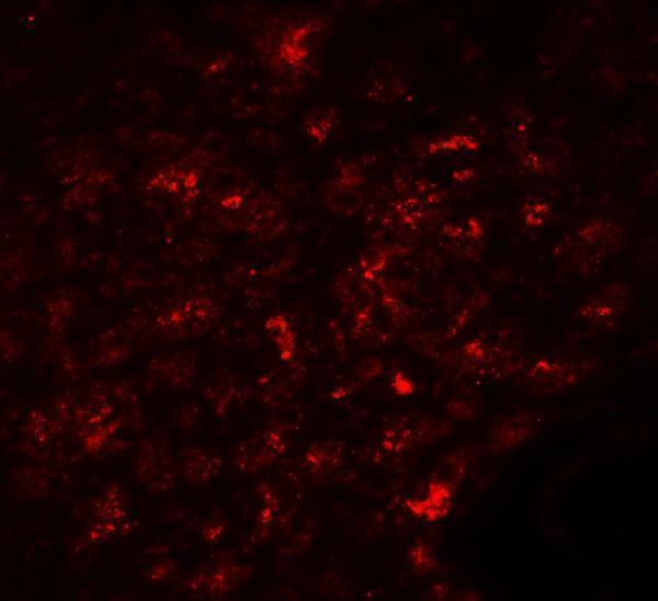 a01310 slc30a8 primary antibodies if testing 3