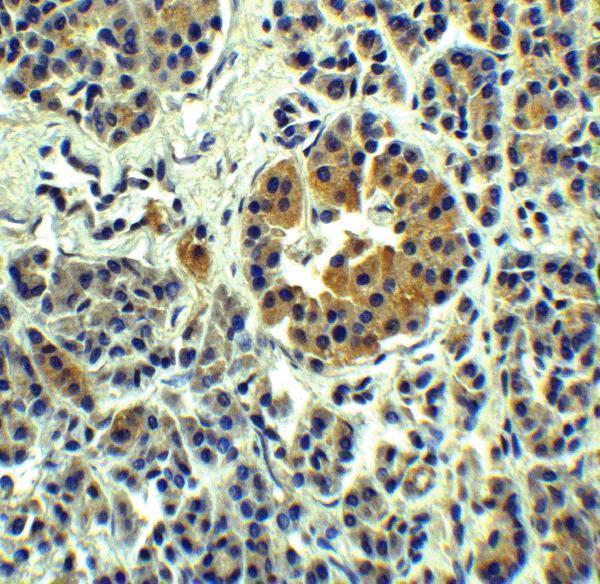 a01310 slc30a8 primary antibodies ihc testing 2