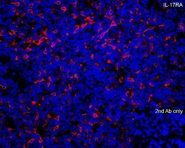 a01311 il17ra primary antibodies if testing 4