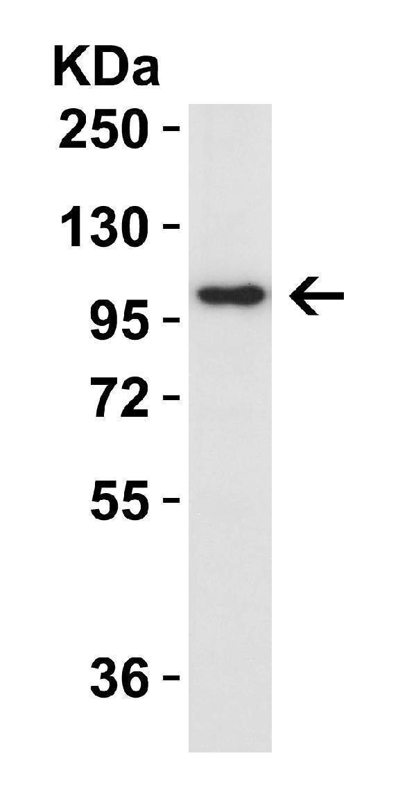 a01311 il17ra primary antibodies wb testing 1