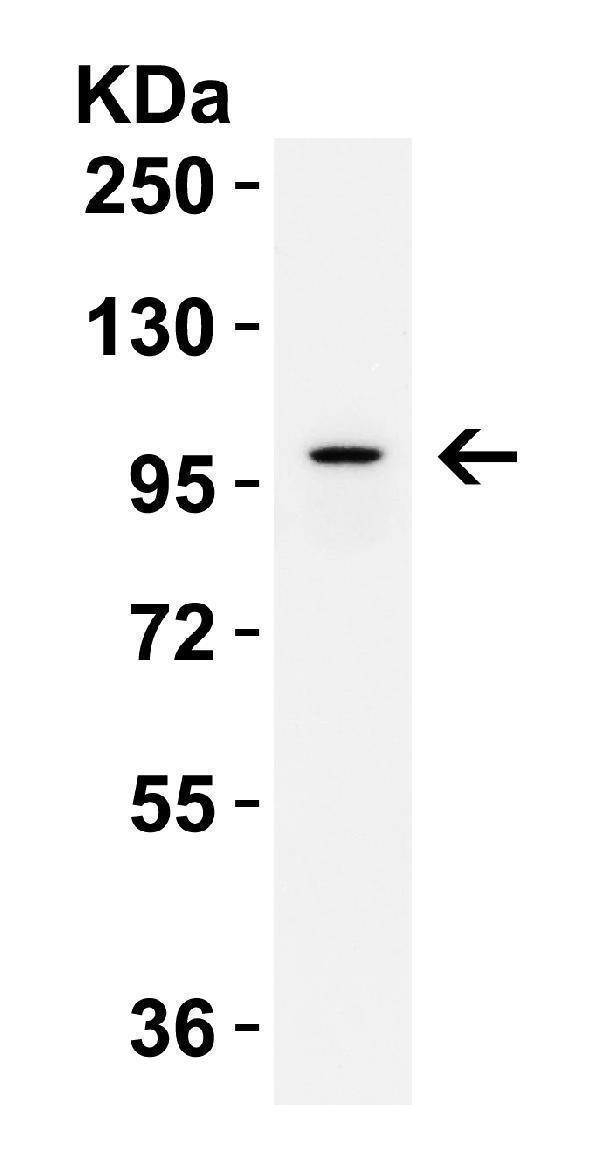 a01311 il17ra primary antibodies wb testing 2