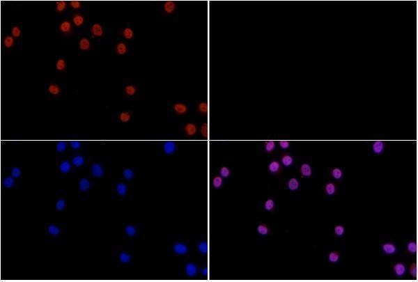 a01315 1 tcf7 primary antiboties if testing 3