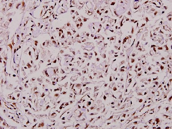 a01315 1 tcf7 primary antiboties ihc testing 2
