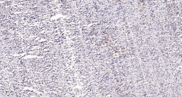 a01315 tcf7 primary antibodies ihc testing 1