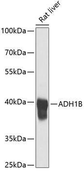 Western blot analysis of extracts of rat liver, using ADH1B antibody  at 1:1000 dilution