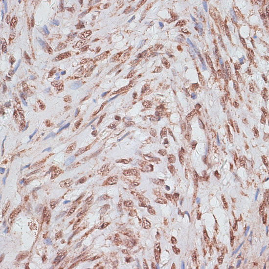Immunohistochemistry of paraffin-embedded human uterus using RPA70/RPA70/RPA1 antibody  at dilution of 1:100 