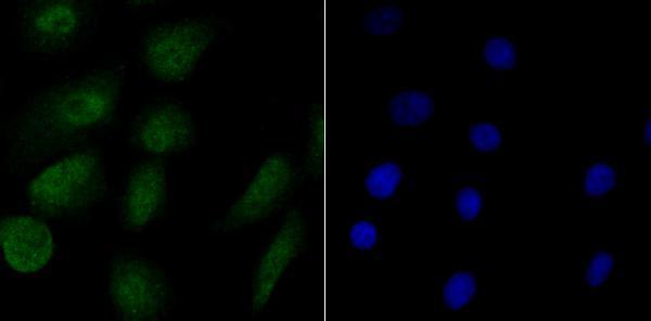 ICC staining RPA70 in A549 cells (green)
