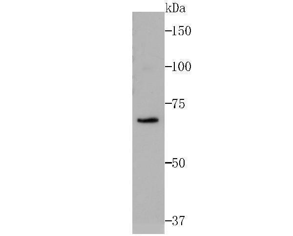 Western blot analysis of RPA70 on Siha cell lysates using anti-RPA70 antibody at 1/500 dilution