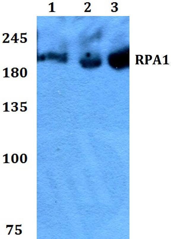 Western blot (WB) analysis of RPA1 polyclonal antibody at 1:500 dilution
Lane1:HEK293T whole cell lysate
Lane2:Raw264