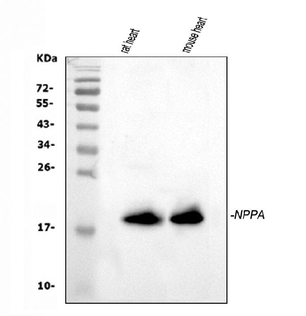 Western blot analysis of ANP using anti-ANP antibody (A01318-1).