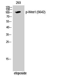 Western Blot analysis of 293 cells using Phospho-Wee1 (S642) Polyclonal Antibody cells nucleus extracted by Minute TM Cytoplasmic and Nuclear Fractionation kit 