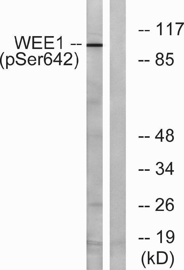 Western blot analysis of lysates from 293 cells treated with etoposide 25uM 60