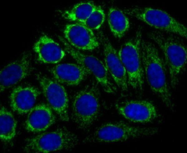 ICC staining CPS1 in HepG2 cells (green)