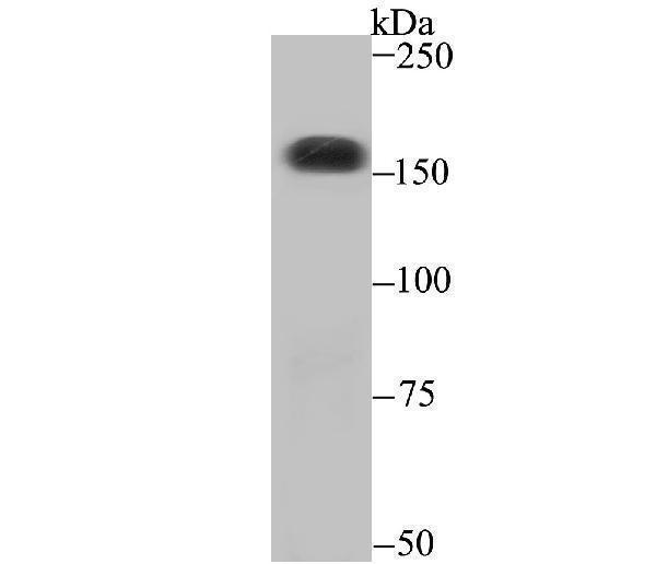 Western blot analysis of CPS1 on SiHa cell using anti-CPS1 antibody at 1/500 dilution