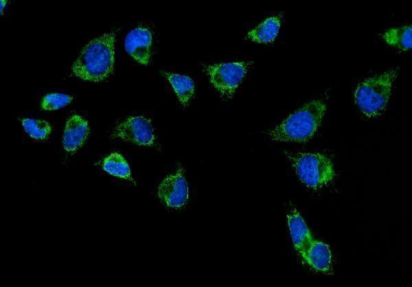a01320 2 cps1 primary antibodies if testing 5