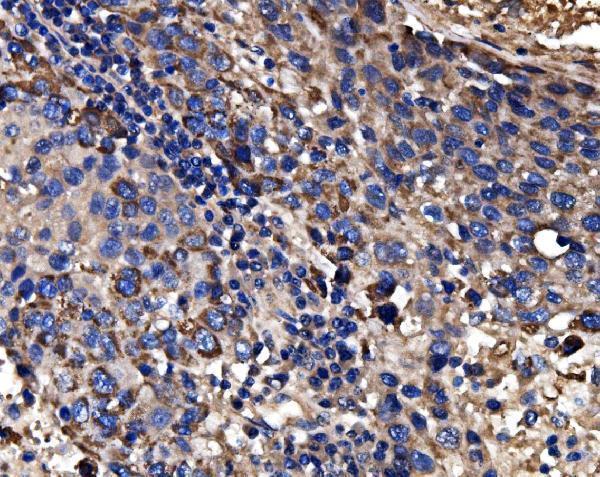  IHC analysis of CPS1 using anti-CPS1 antibody (A01320-2)