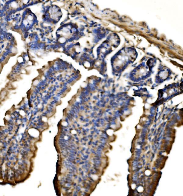  IHC analysis of CPS1 using anti-CPS1 antibody (A01320-2)
