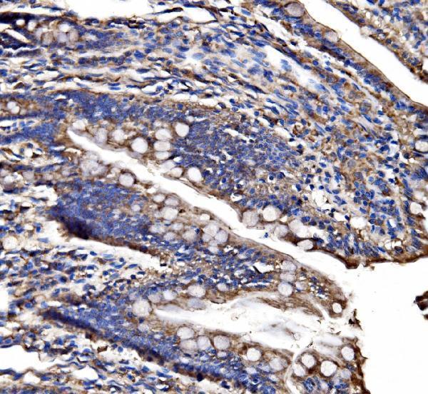 a01320 2 cps1 primary antibodies ihc testing 4