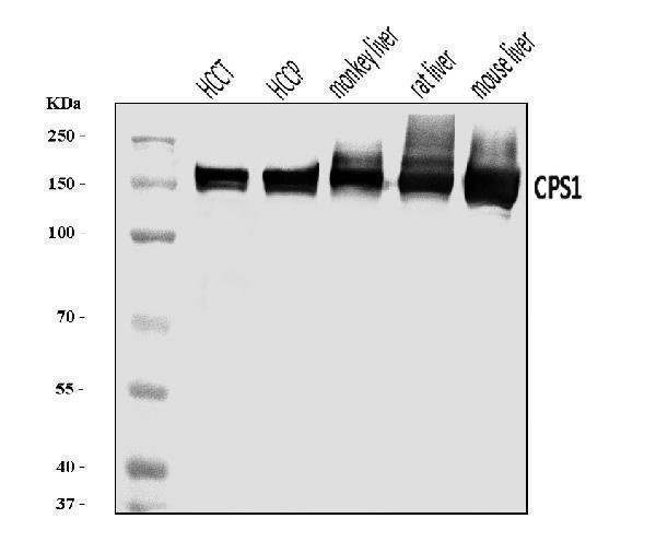  Western blot analysis of CPS1 using anti-CPS1 antibody (A01320-2)