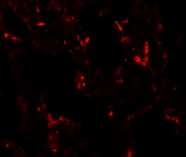 Immunofluorescence of NKX2-1 in human lung tissue with NKX2-1 antibody at 20 μg/mL