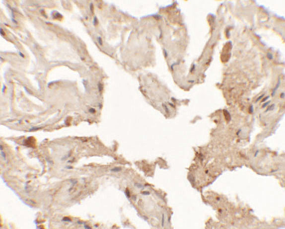 Immunohistochemistry of NKX2-1 in human lung tissue with NKX2-1 antibody at 2