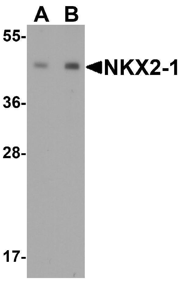 Western blot analysis of NKX2-1 expression in human lung tissue lysate with NKX2-1 antibody at (A) 0