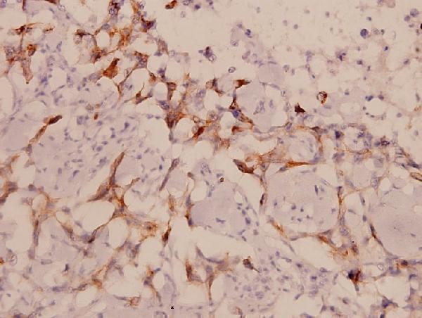 a01323 limk1 primary antiboties ihc testing 2