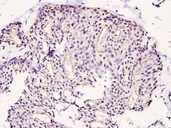 a01323t508 limk1 primary antiboties ihc testing 2