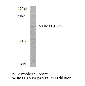 a01323t508 limk1 primary antiboties wb testing 1_1