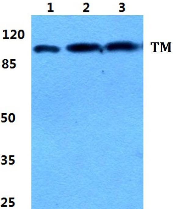 Western blot (WB) analysis of Thrombomodulin polyclonal antibody at 1:500 dilution
Lane1:HEK293T cell lysate
Lane2:Raw264
