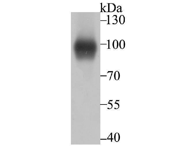 Western blot analysis of Thrombomodulin on A431 cell using anti-Thrombomodulin antibody at 1/500 dilution