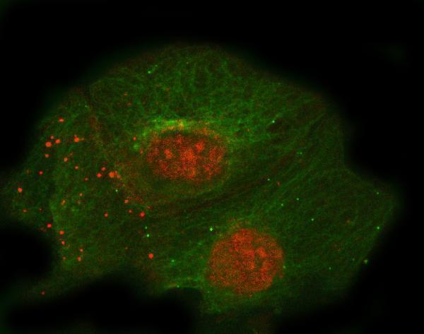 a01325 3 thbd primary antibodies if testing 4
