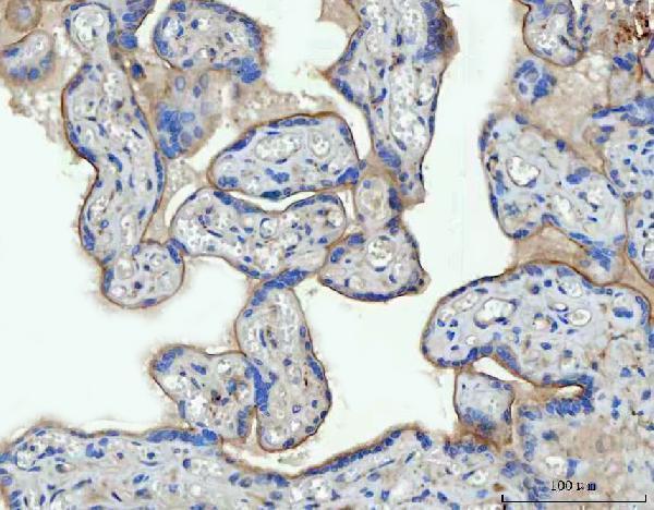  IHC analysis of Thrombomodulin/THBD using anti-Thrombomodulin/THBD antibody (A01325-3)