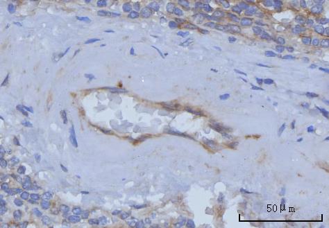  IHC analysis of Thrombomodulin/THBD using anti-Thrombomodulin/THBD antibody (A01325-3)