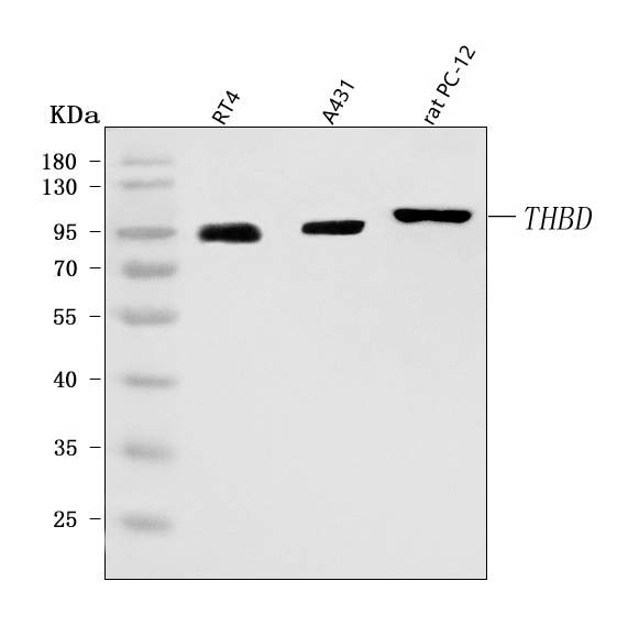  Western blot analysis of Thrombomodulin/THBD using anti-Thrombomodulin/THBD antibody (A01325-3)