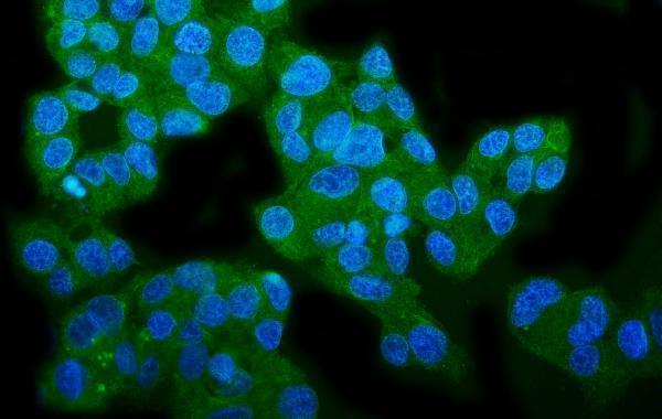 a01326 1 wfs1 primary antibodies if testing 3