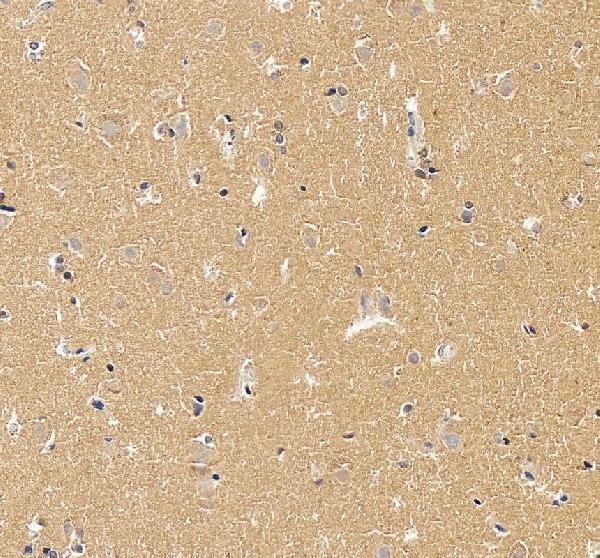 a01326 1 wfs1 primary antibodies ihc testing 3