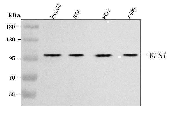 a01326 2 wfs1 primary antibodies wb testing 1