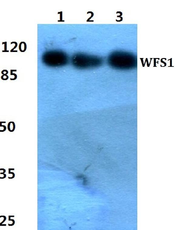 a01326 wfs1 primary antiboties wb testing 1