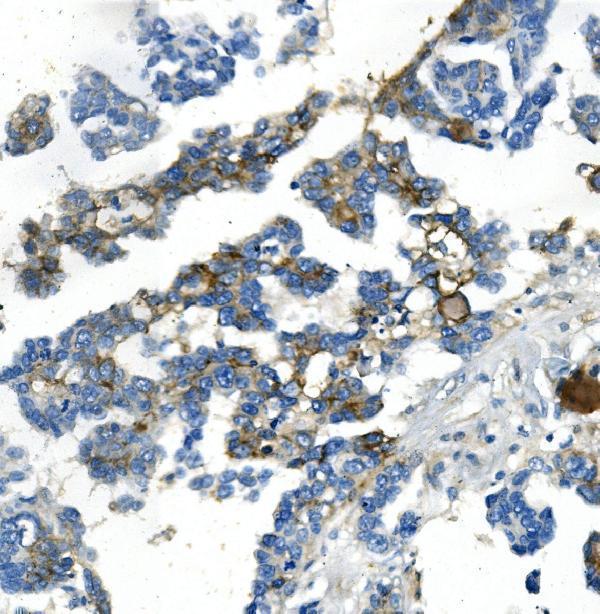 a01327 1 ndrg1 primary antibodies ihc testing 1