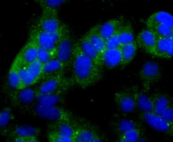 a01327 2 ndrg1 primary antiboties icc testing 2