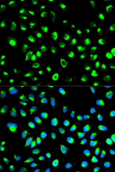 Immunofluorescence analysis of MCF7 cells, using NDRG1 polyclonal antibody