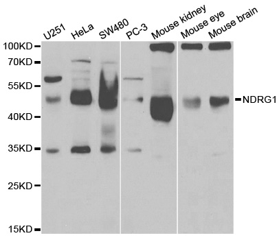 Western blot analysis of NDRG1 polyclonal antibody