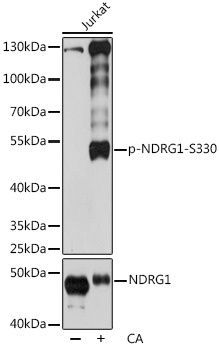 Western blot analysis of extracts of Jurkat cells, using Phospho-NDRG1-S330 pAb  at 1:2000 dilution or NDRG1 antibody 