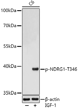 Western blot analysis of extracts of C6 cells, using Phospho-NDRG1-T346 antibody  at 1:1000 dilution