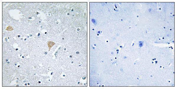a01331 1 cit primary antibodies ihc testing 1